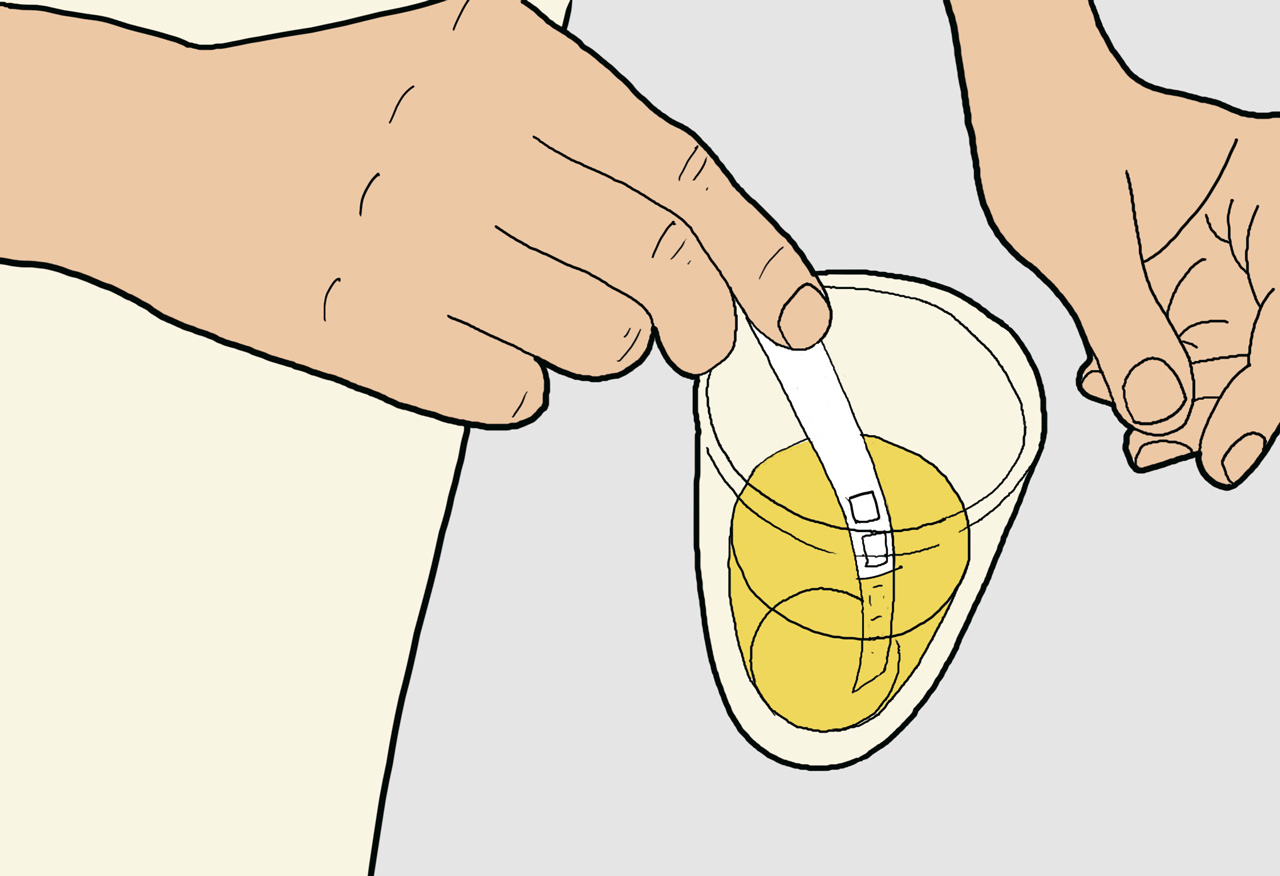 02_8 glucose in urine